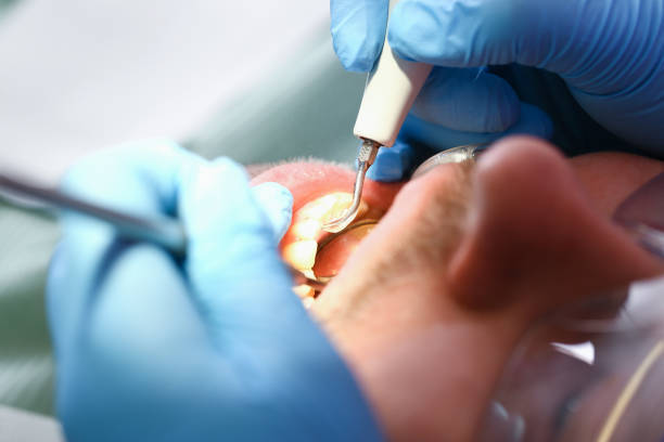 Best Walk-In Emergency Dental Services in Middle Valley, TN
